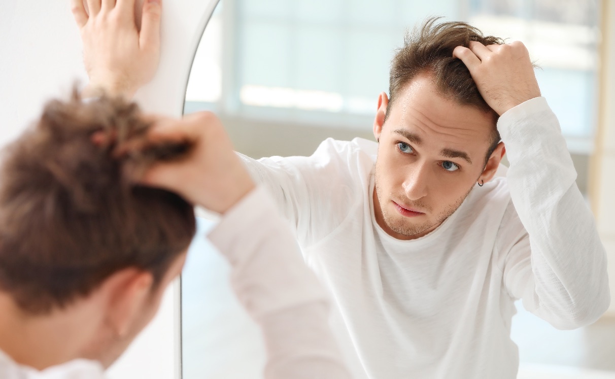 Hair Transplant: Answers to the Most Common Questions